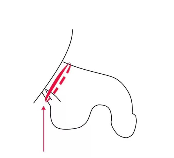 img_7748 Desire Chainmail Steel Chastity Cage